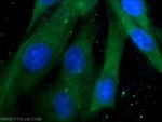 alpha Tubulin Antibody in Immunocytochemistry (ICC/IF)