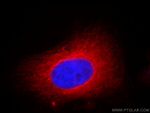 alpha Tubulin Antibody in Immunocytochemistry (ICC/IF)