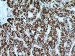 IVD Antibody in Immunohistochemistry (Paraffin) (IHC (P))