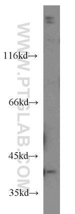 IVD Antibody in Western Blot (WB)