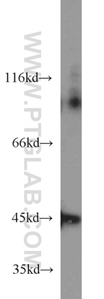 IVD Antibody in Western Blot (WB)