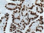 TTF-1 Antibody in Immunohistochemistry (Paraffin) (IHC (P))