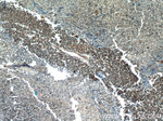 TTF-1 Antibody in Immunohistochemistry (Paraffin) (IHC (P))