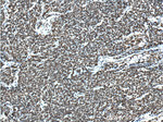 TTF-1 Antibody in Immunohistochemistry (Paraffin) (IHC (P))