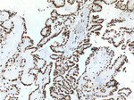 TTF-1 Antibody in Immunohistochemistry (Paraffin) (IHC (P))