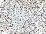 TTF-1 Antibody in Immunohistochemistry (Paraffin) (IHC (P))