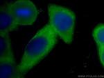 Annexin A2 Antibody in Immunocytochemistry (ICC/IF)