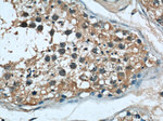 ASS1 Antibody in Immunohistochemistry (Paraffin) (IHC (P))