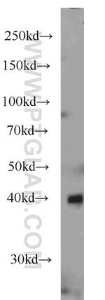 ASS1 Antibody in Western Blot (WB)