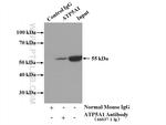 ATP5A1 Antibody in Immunoprecipitation (IP)