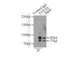 CUL4A Antibody in Immunoprecipitation (IP)