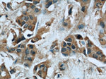 CUL4A Antibody in Immunohistochemistry (Paraffin) (IHC (P))