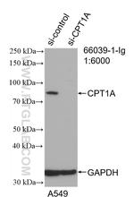 CPT1A Antibody in Western Blot (WB)