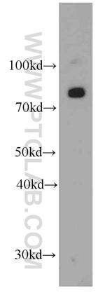 CPT1A Antibody in Western Blot (WB)