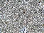 CPT1A Antibody in Immunohistochemistry (Paraffin) (IHC (P))