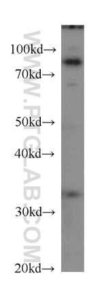 CPT1A Antibody in Western Blot (WB)