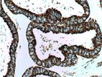 HSP60 Antibody in Immunohistochemistry (Paraffin) (IHC (P))