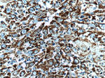 HSP60 Antibody in Immunohistochemistry (Paraffin) (IHC (P))