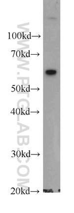 HSP60 Antibody in Western Blot (WB)