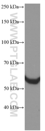 HSP60 Antibody in Western Blot (WB)