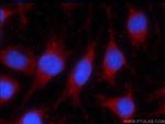 LONP1 Antibody in Immunocytochemistry (ICC/IF)