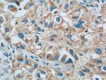 LONP1 Antibody in Immunohistochemistry (Paraffin) (IHC (P))