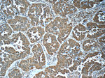 LONP1 Antibody in Immunohistochemistry (Paraffin) (IHC (P))