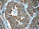 LONP1 Antibody in Immunohistochemistry (Paraffin) (IHC (P))