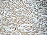 LONP1 Antibody in Immunohistochemistry (Paraffin) (IHC (P))