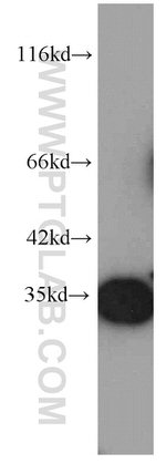 RPS3 Antibody in Western Blot (WB)