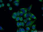 Cyclophilin B Antibody in Immunocytochemistry (ICC/IF)