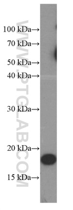 Cyclophilin B Antibody in Western Blot (WB)