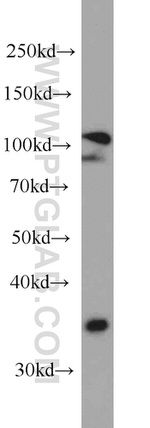 MMS19 Antibody in Western Blot (WB)