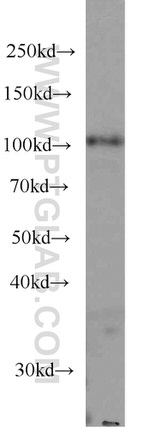 MMS19 Antibody in Western Blot (WB)