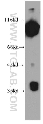 MMS19 Antibody in Western Blot (WB)