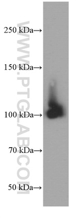 MMS19 Antibody in Western Blot (WB)