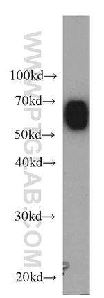 Albumin Antibody in Western Blot (WB)