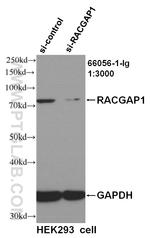 RACGAP1 Antibody in Western Blot (WB)