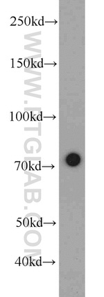 RACGAP1 Antibody in Western Blot (WB)