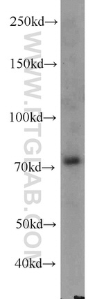 RACGAP1 Antibody in Western Blot (WB)