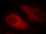 Cofilin Antibody in Immunocytochemistry (ICC/IF)