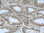 Cofilin Antibody in Immunohistochemistry (Paraffin) (IHC (P))