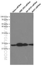 Cofilin Antibody in Western Blot (WB)