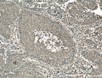 Cofilin Antibody in Immunohistochemistry (Paraffin) (IHC (P))