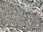 Cofilin Antibody in Immunohistochemistry (Paraffin) (IHC (P))