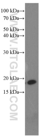 Cofilin Antibody in Western Blot (WB)