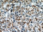 RAB27A Antibody in Immunohistochemistry (Paraffin) (IHC (P))