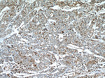 RAB27A Antibody in Immunohistochemistry (Paraffin) (IHC (P))