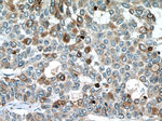 RAB27A Antibody in Immunohistochemistry (Paraffin) (IHC (P))