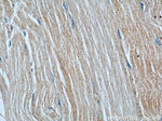 RAB27A Antibody in Immunohistochemistry (Paraffin) (IHC (P))